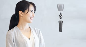 こだわりのインプラント
